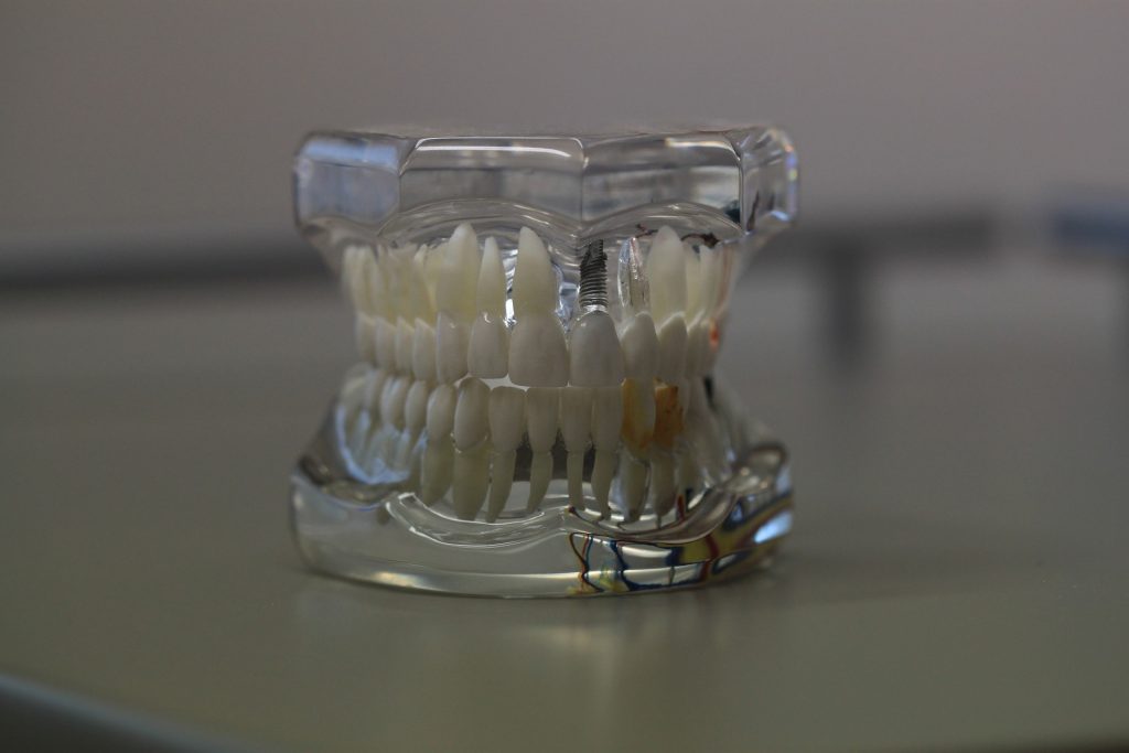 Salva la 72enne che ha inalato pezzi di dentiera
