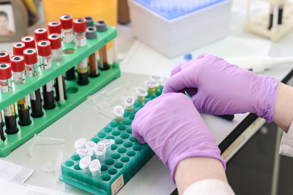 Flop Blenrep, addio al farmaco anti cancro