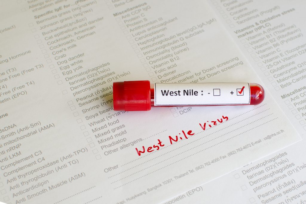Oristano, contagio virus West Nile